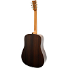 Акустическая гитара Tyrone SILVER D Rosewood - 2